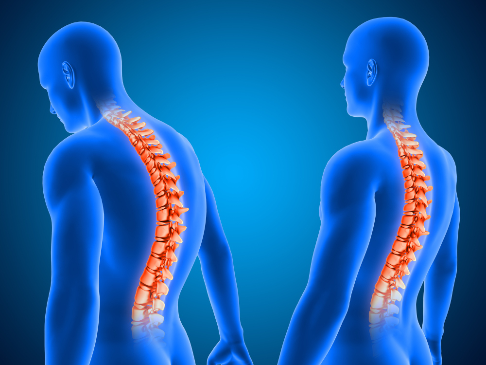Posture Therapy Ayurveda